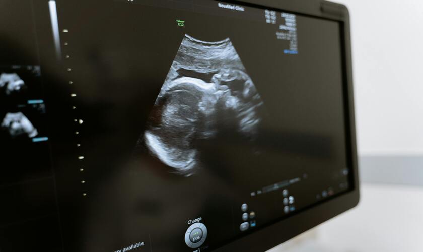 embarazos en adolescentes